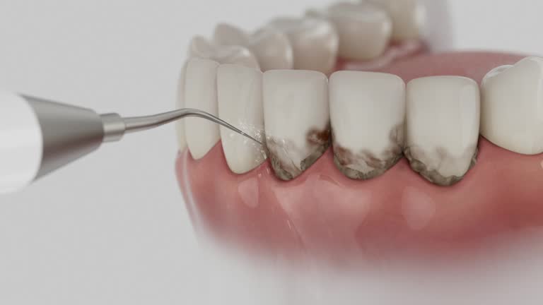 Reliable Dental Implants contractor in Thousand Palms, CA by Smile Center Dentistry